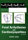 Fetal Arrhythmias and Cardiomyopathies - simplified