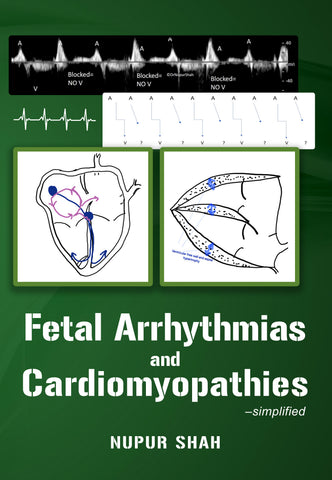 [Pre-Order] Fetal Arrhythmias and Cardiomyopathies-simplified