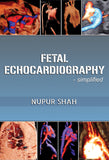 Fetal Echocardiography - Simplified